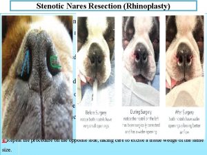 Stenotic Nares Resection Rhinoplasty 1 Grasp the margin