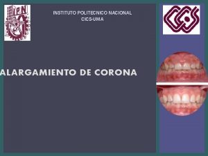 INSTITUTO POLITECNICO NACIONAL CICSUMA ALARGAMIENTO DE CORONA INTRODUCCIN