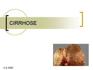 CIRRHOSE A S 2006 Dfinition histologique Fibrose mutilante
