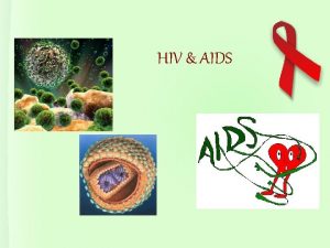 HIV AIDS O JE HIV Human Immunodeficiency Virus