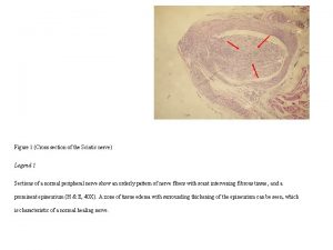 Figure 1 Cross section of the Sciatic nerve