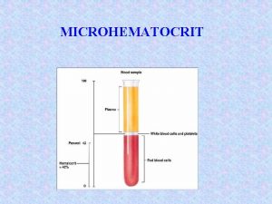 MICROHEMATOCRIT MICROHEMATOCRIT Packed Cell Volume of Whole Blood