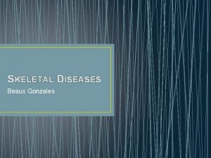 SKELETAL DISEASES Beaux Gonzales Rheumatoid Arthritis Beaux Gonzales
