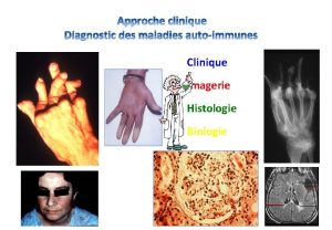 Clinique Imagerie Histologie Biologie Spcifiques dorgane Diabte Thyrodite