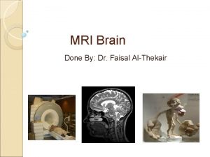 MRI Brain Done By Dr Faisal AlThekair MRI