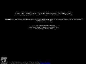 Cardiomyocyte Hypertrophy in Arrhythmogenic Cardiomyopathy Mustafa Gerek Muhammed