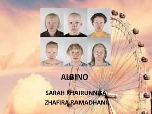 ALBINO SARAH KHAIRUNNISA ZHAFIRA RAMADHANI Apa itu Albino