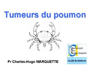 Tumeurs du poumon Pr CharlesHugo MARQUETTE Cancers bronchiques