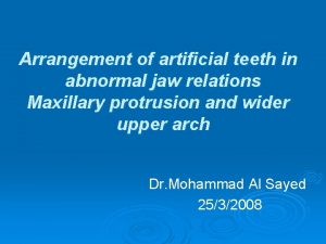 Arrangement of artificial teeth in abnormal jaw relations