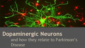 Dopaminergic Neurons and how they relate to Parkinsons