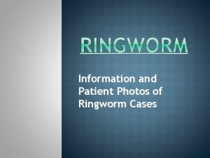 Information and Patient Photos of Ringworm Cases Ringworm