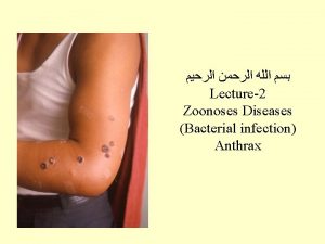 Lecture2 Zoonoses Diseases Bacterial infection Anthrax Anthrax Anthrax