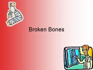 Broken Bones Bones Bones are connective tissue Bones