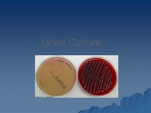 Urine Culture Urine Gram Stain Urine Culture Quantitation