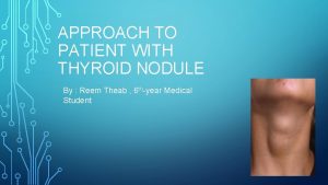APPROACH TO PATIENT WITH THYROID NODULE By Reem