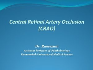 Central Retinal Artery Occlusion CRAO Dr Ramezani Assistant