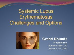 Systemic Lupus Erythematosus Challenges and Options Grand Rounds