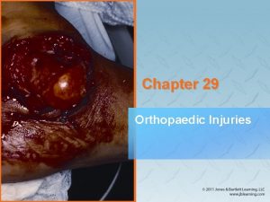 Chapter 29 Orthopaedic Injuries National EMS Education Standard