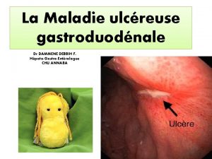 La Maladie ulcreuse gastroduodnale Dr DAMMENE DEBBIH F