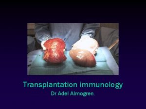 Transplantation immunology Dr Adel Almogren Transfusion vs Transplantation