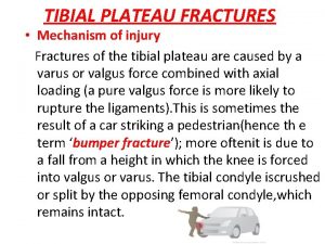 TIBIAL PLATEAU FRACTURES Mechanism of injury Fractures of