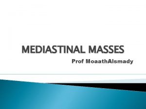 MEDIASTINAL MASSES Prof Moaath Alsmady Benign or malignant