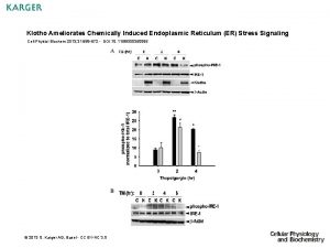 Klotho Ameliorates Chemically Induced Endoplasmic Reticulum ER Stress