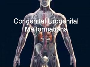 Congenital Urogenital Malformations Prefinal Topics Renal agenesis Renal