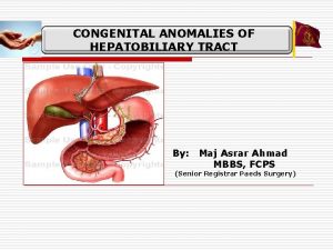 CONGENITAL ANOMALIES OF HEPATOBILIARY TRACT By Maj Asrar