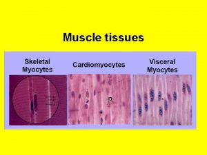 Muscle tissues Muscle tissue Muscle cells myocytes are