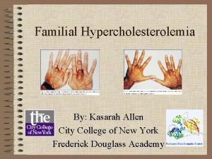 Familial Hypercholesterolemia By Kasarah Allen City College of