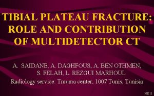 TIBIAL PLATEAU FRACTURE ROLE AND CONTRIBUTION OF MULTIDETECTOR