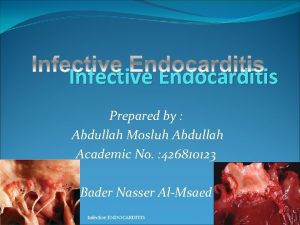 Infective Endocarditis Prepared by Abdullah Mosluh Abdullah Academic