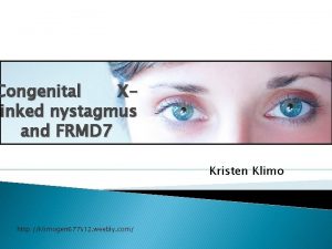 Congenital Xlinked nystagmus and FRMD 7 Kristen Klimo