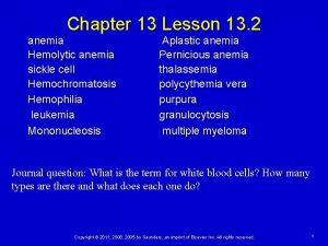 Chapter 13 Lesson 13 2 anemia Hemolytic anemia