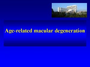 Agerelated macular degeneration Agerelated macular degeneration AMD The