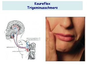 Kaureflex Trigeminusschmerz N trigeminus sens Kerne Nucl tr