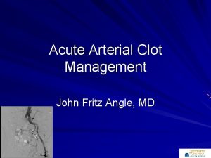Acute Arterial Clot Management John Fritz Angle MD