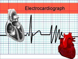 Electrocardiograph History 1842 Italian scientist Carlo Matteucci realizes