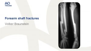 Forearm shaft fractures Volker Braunstein Learning outcomes At