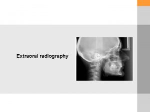 Extraoral radiography MAIN MAXILLOFACIAL PROJECTION Standard occipitomental 0