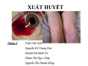 XUT HUYT Nhm 1 Trn Vn Tin Nguyn