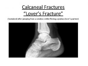 Calcaneal Fractures Lovers Fracture Sustained after jumping from