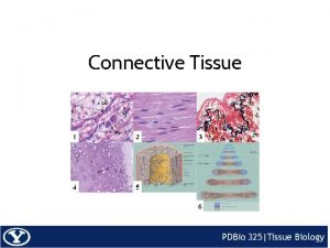 Connective Tissue General Types of Connective Tissue Loose