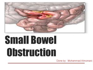 Small Bowel Obstruction Done by Mohammad Almomani Outline