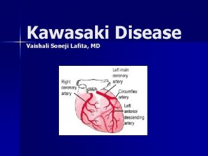 Kawasaki Disease Vaishali Soneji Lafita MD Presentation Patient