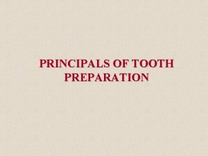 PRINCIPALS OF TOOTH PREPARATION PRINCIPALS OF TOOTH PREPARATION