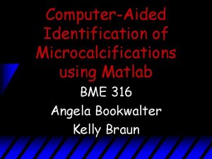ComputerAided Identification of Microcalcifications using Matlab BME 316