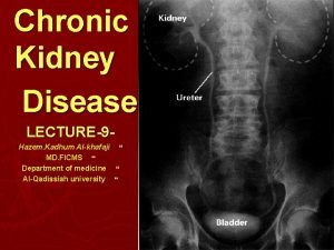 Chronic Anatomy Kidney Disease LECTURE9 Hazem Kadhum Alkhafaji