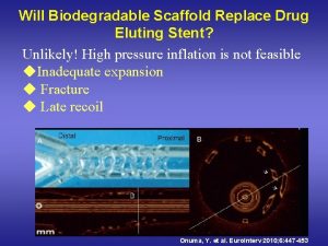 Will Biodegradable Scaffold Replace Drug Eluting Stent Unlikely